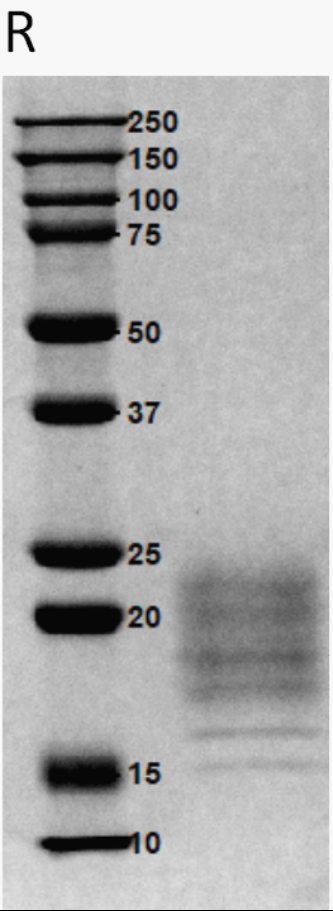 2、SDS-PAGE.jpg